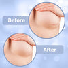 Miztag Home &amp; Health Breast reduction recovery supplies after surgery needs - Silicone scar sheets for surgical scars - Comfortable under Post op Bra